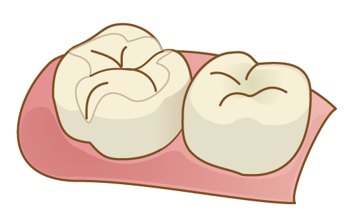 あもう歯科セラミック